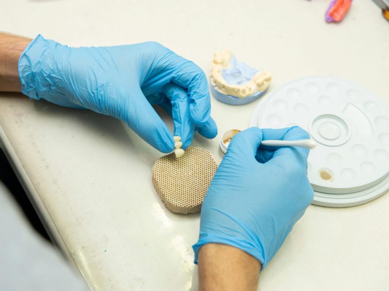 Prótesis dental. Clínica Bueno & Marquina